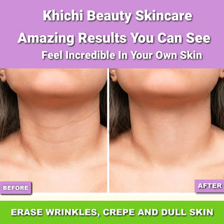 Khichi Beauty Ultra Repair Firming Neck Cream - Khichi Beauty Skincare by WWW.ALESMAXII.COM