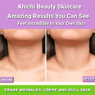 Khichi Beauty Ultra Repair Firming Neck Cream
