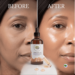Khichi Beauty Apricot Oil, Organic, Pure and Natural, 3.38oz (100ml). - Khichi Beauty Skincare, Alesmaxii.com