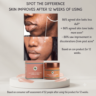 Khichi Beauty Dark Spots And Blemishes Corrector Cream - Khichi Beauty Skincare, Alesmaxii.com