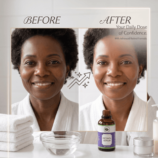 Khichi Beauty Deep Wrinkle Resurfacing Retinol Serum,1 oz, (30ml). - Khichi Beauty Skincare, Alesmaxii.com