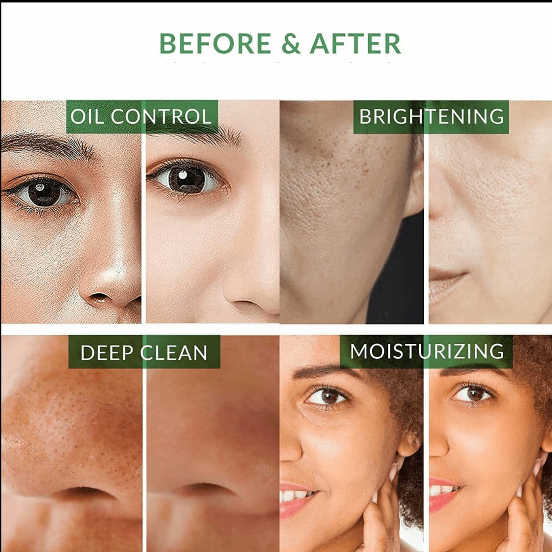 Khichi Beauty Turmeric Face Mask Treating and Repairing, Oil Control