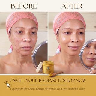 Khichi Beauty Turmeric Facial Polish, With Real Turmeric Juice, 150 / 5.1 fl oz - Khichi Beauty Skincare, Alesmaxii.com